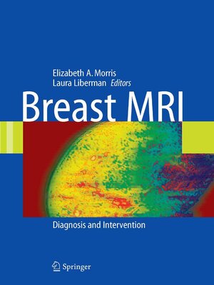 cover image of Breast MRI